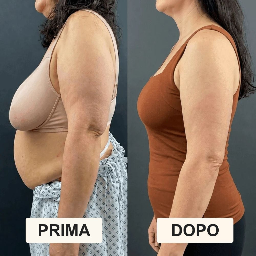 Prima e dopo profilo