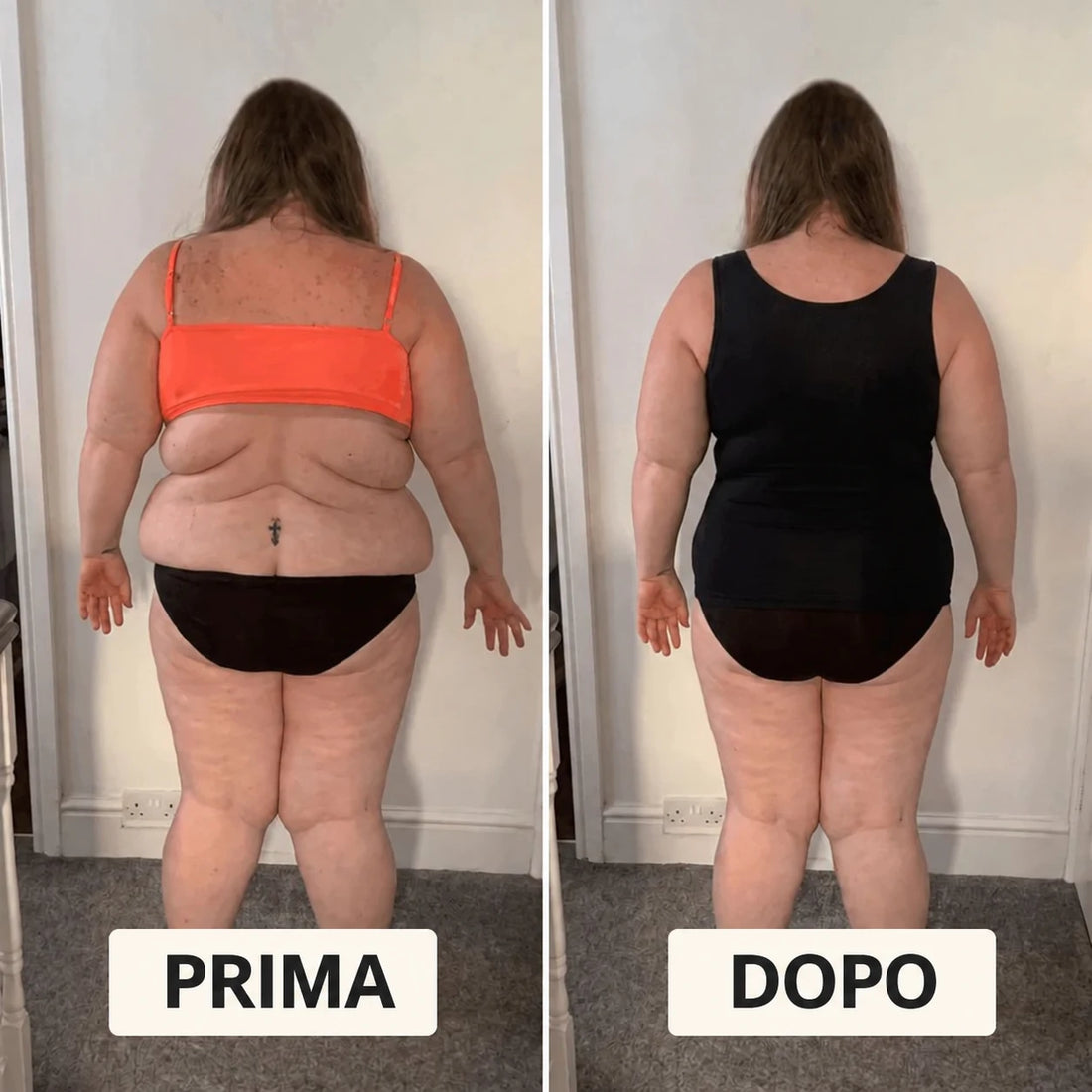 Prima e dopo schiena